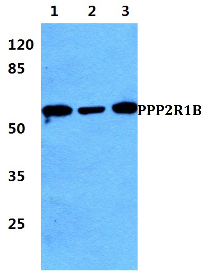 PPP2R1B Antibody in Western Blot (WB)