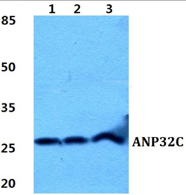 ANP32C Antibody in Western Blot (WB)