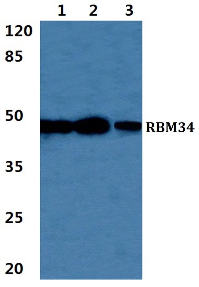 RBM34 Antibody in Western Blot (WB)