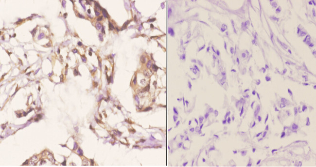 RTCA Antibody in Immunohistochemistry (Paraffin) (IHC (P))
