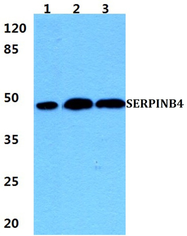 SERPINB4 Antibody in Western Blot (WB)