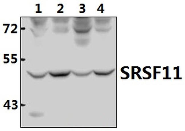 SRSF11 Antibody in Western Blot (WB)