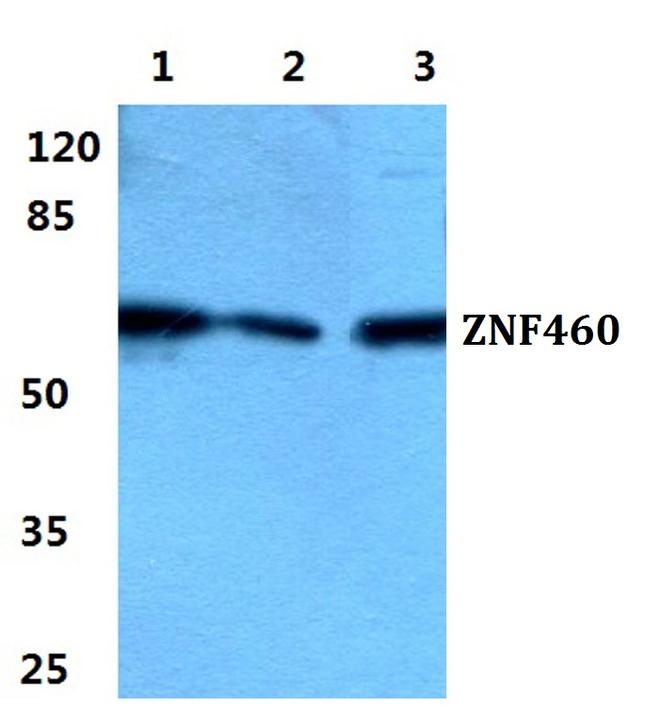 ZNF460 Antibody in Western Blot (WB)