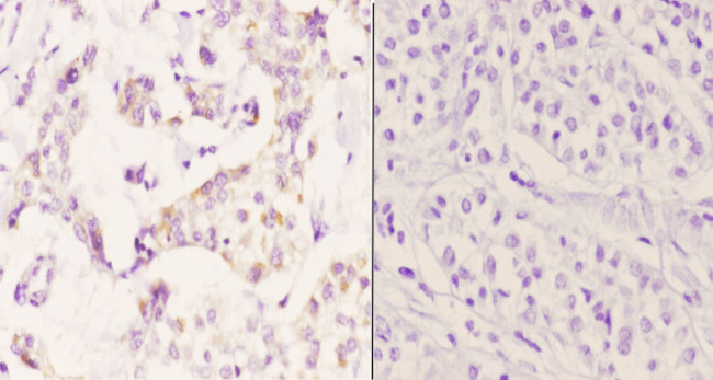 PTGR2 Antibody in Immunohistochemistry (Paraffin) (IHC (P))