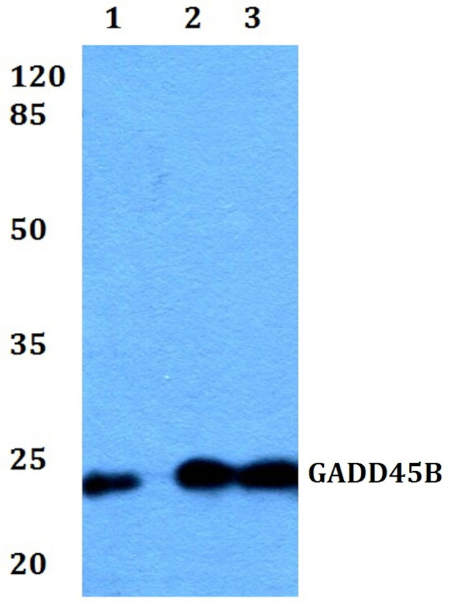 GADD45B Antibody in Western Blot (WB)