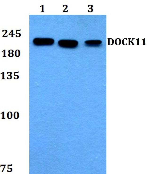 DOCK11 Antibody in Western Blot (WB)