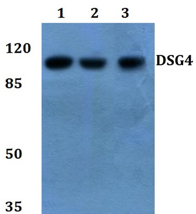 Desmoglein 4 Antibody in Western Blot (WB)