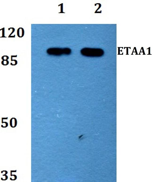 ETAA1 Antibody in Western Blot (WB)