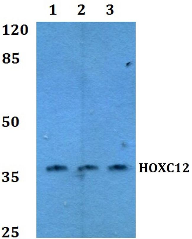 HOXC12 Antibody in Western Blot (WB)
