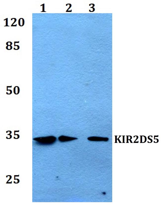 KIR2DS5 Antibody in Western Blot (WB)