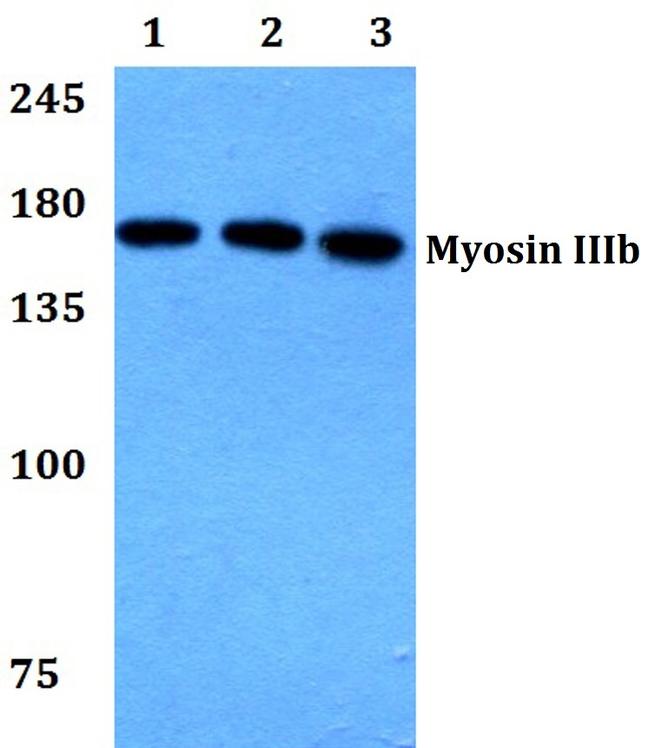 MYO3B Antibody in Western Blot (WB)