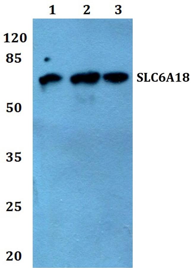 SLC6A18 Antibody in Western Blot (WB)