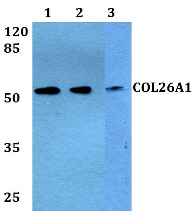 COL26A1 Antibody in Western Blot (WB)