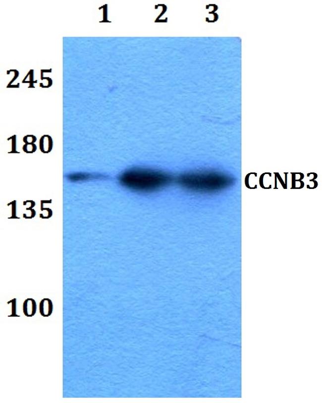 Cyclin B3 Antibody in Western Blot (WB)