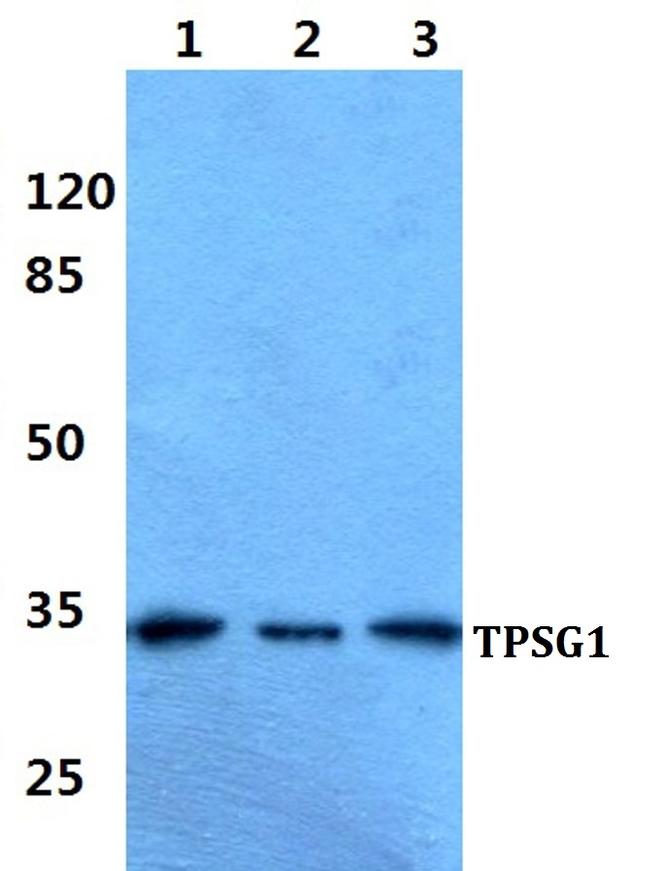 TPSG1 Antibody in Western Blot (WB)
