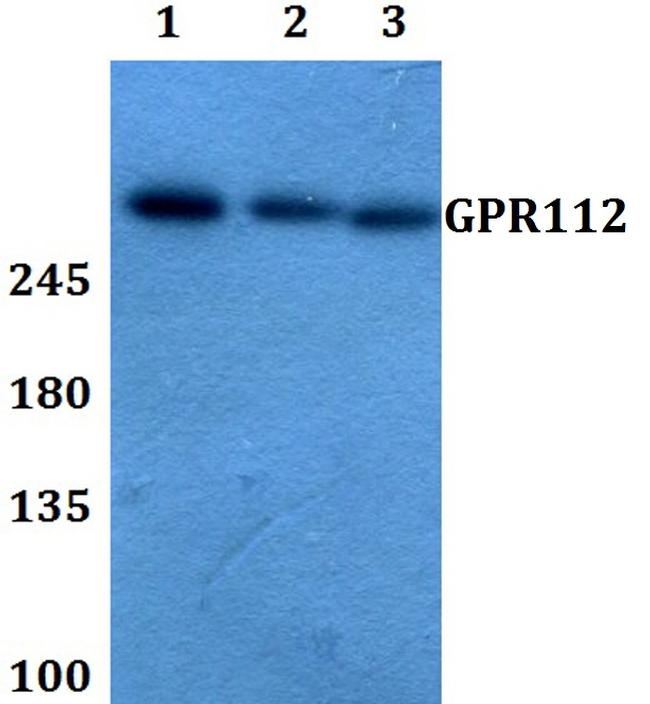 GPR112 Antibody in Western Blot (WB)