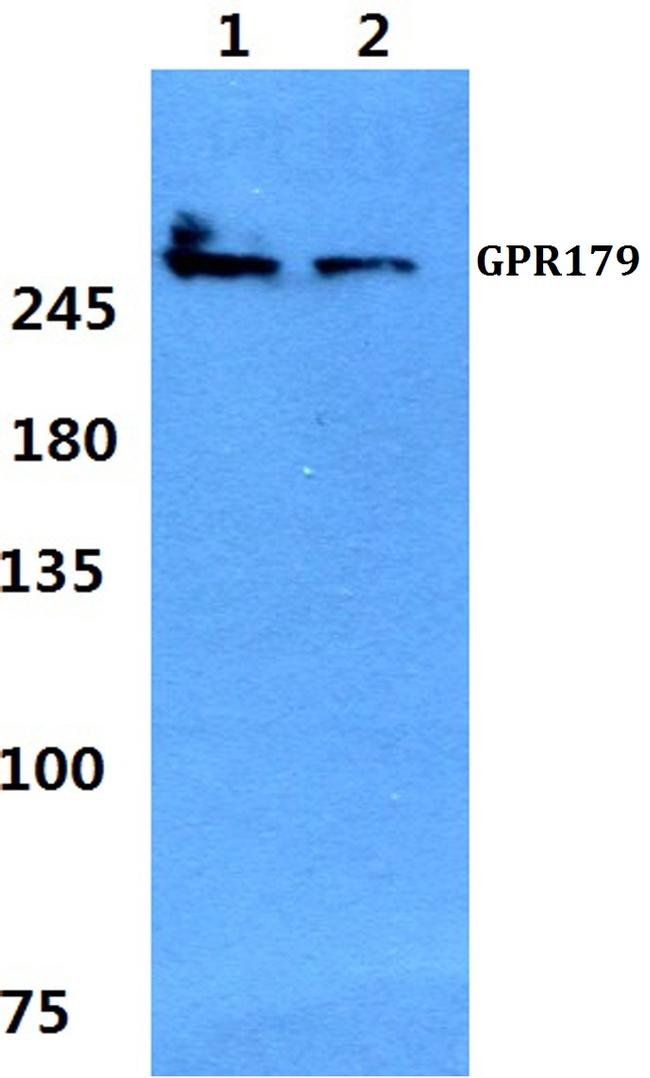GPR179 Antibody in Western Blot (WB)