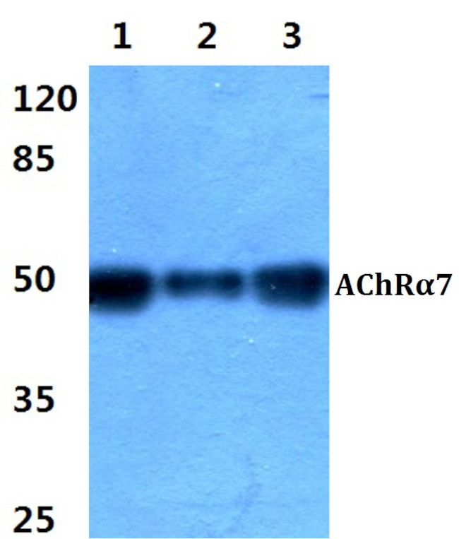 CHRNA7 Antibody in Western Blot (WB)