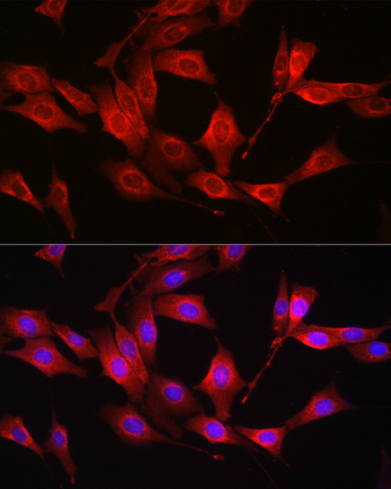 GSS Antibody in Immunocytochemistry (ICC/IF)