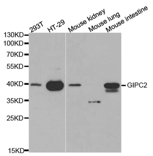 GIPC2 Antibody in Western Blot (WB)