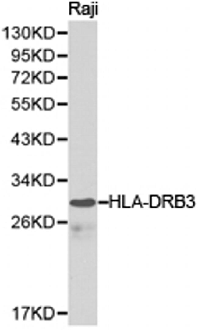 HLA-DRB3 Antibody in Western Blot (WB)