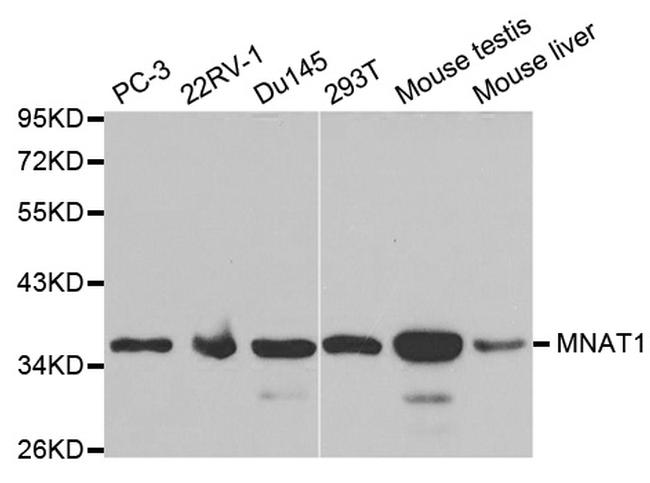 MNAT1 Antibody in Western Blot (WB)