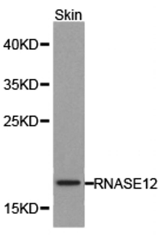 RNase12 Antibody in Western Blot (WB)
