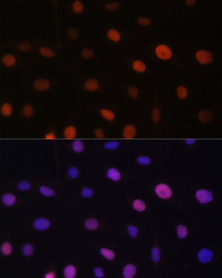 UHRF2 Antibody in Immunocytochemistry (ICC/IF)