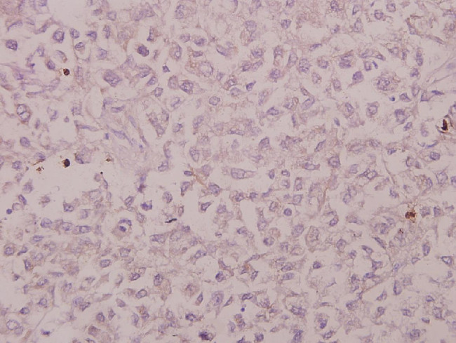 CRSP130 Antibody in Immunohistochemistry (Paraffin) (IHC (P))