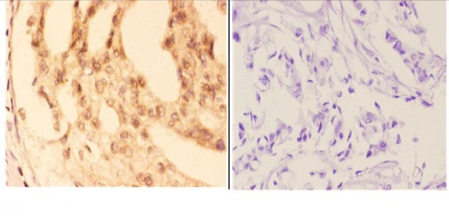 COL19A1 Antibody in Immunohistochemistry (Paraffin) (IHC (P))