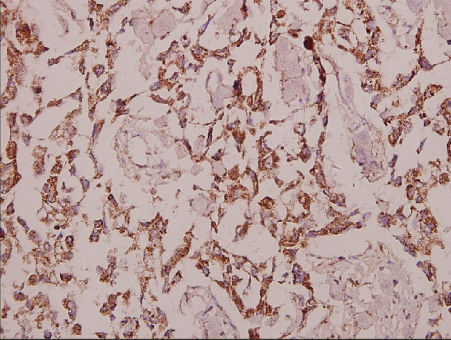 GCP3 Antibody in Immunohistochemistry (Paraffin) (IHC (P))