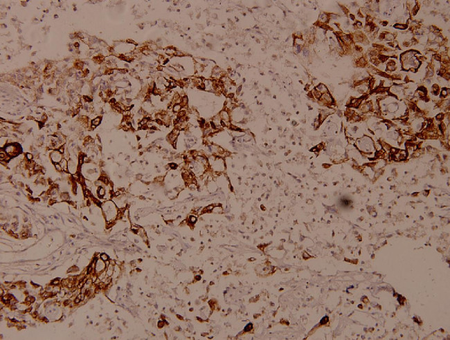 SPINK5 Antibody in Immunohistochemistry (Paraffin) (IHC (P))