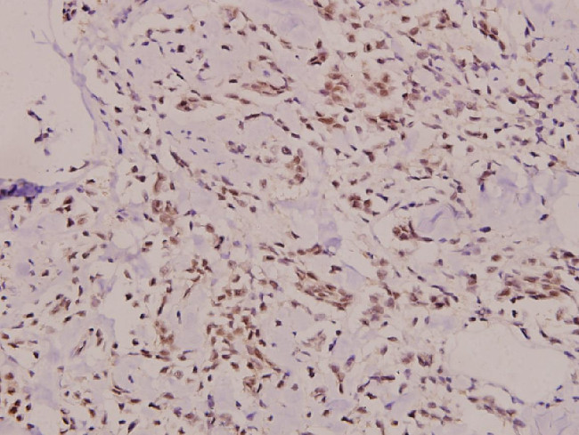 SH2D2A Antibody in Immunohistochemistry (Paraffin) (IHC (P))