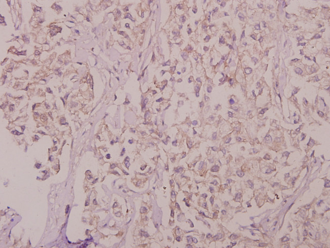 SLC30A1 Antibody in Immunohistochemistry (Paraffin) (IHC (P))