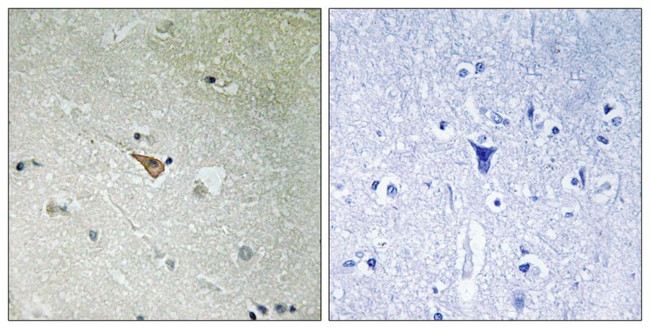 Phospho-ALK (Tyr1096) Antibody in Immunohistochemistry (Paraffin) (IHC (P))