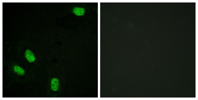 Phospho-Progesterone Receptor (Ser294) Antibody in Immunocytochemistry (ICC/IF)