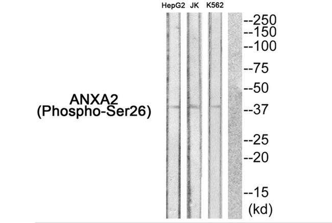 Phospho-Annexin A2 (Ser26) Antibody in Western Blot (WB)