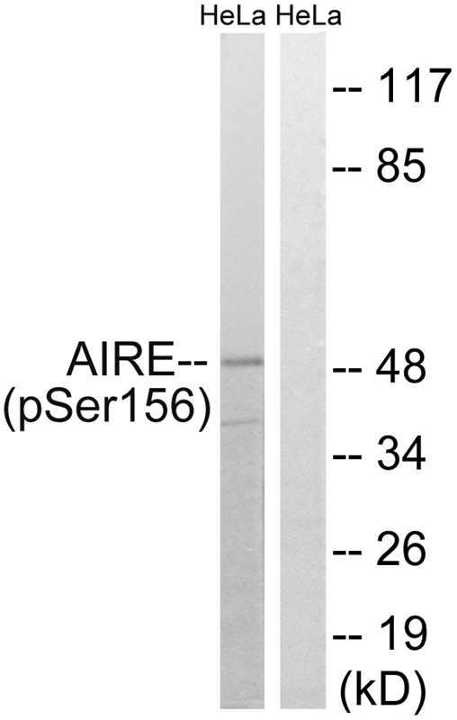 Phospho-AIRE (Ser156) Antibody in Western Blot (WB)