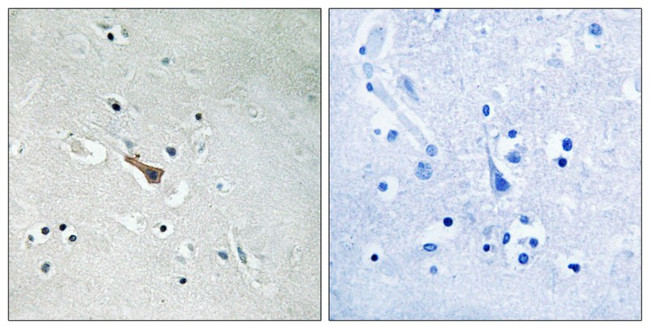 Phospho-APLP2 (Tyr755) Antibody in Immunohistochemistry (Paraffin) (IHC (P))