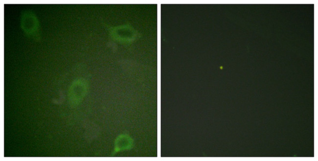 Phospho-Amyloid Precursor Protein (Thr743, Thr668) Antibody in Immunocytochemistry (ICC/IF)