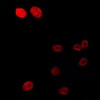 Phospho-Androgen Receptor (Ser213) Antibody in Immunocytochemistry (ICC/IF)