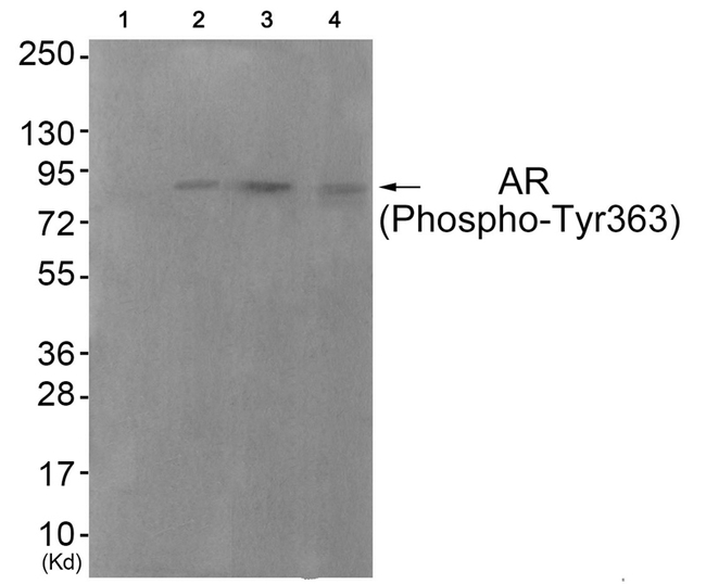 Phospho-Androgen Receptor (Tyr363) Antibody in Western Blot (WB)