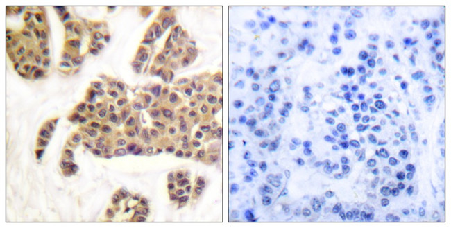 Phospho-BAD (Ser91, Ser128) Antibody in Immunohistochemistry (Paraffin) (IHC (P))
