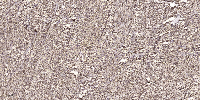 Phospho-Cyclin D1 (Thr286) Antibody in Immunohistochemistry (Paraffin) (IHC (P))