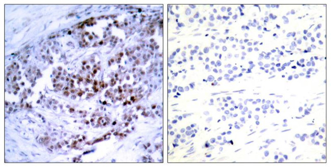 Phospho-Bcl-2 (Ser70) Antibody in Immunohistochemistry (Paraffin) (IHC (P))