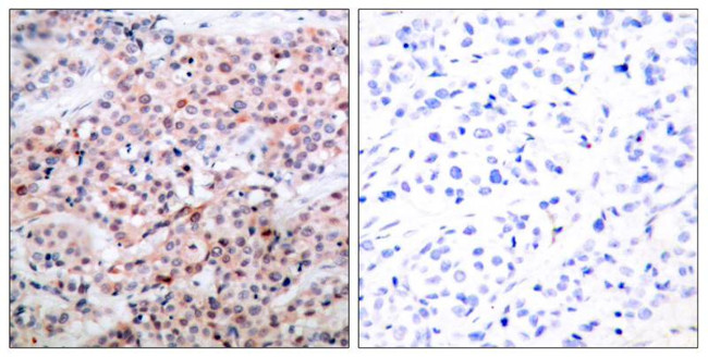 Phospho-Bcl-2 (Thr56) Antibody in Immunohistochemistry (Paraffin) (IHC (P))