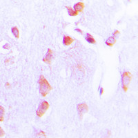 Phospho-Bcl-2 (Thr69) Antibody in Immunohistochemistry (Paraffin) (IHC (P))