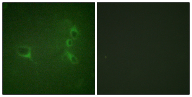 Phospho-BCR (Tyr360) Antibody in Immunocytochemistry (ICC/IF)