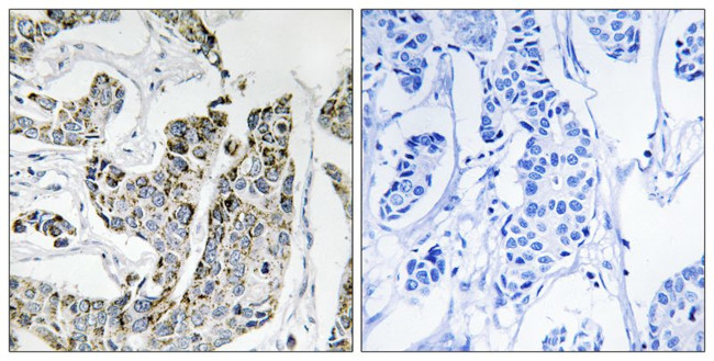 Phospho-BLK (Tyr501) Antibody in Immunohistochemistry (Paraffin) (IHC (P))