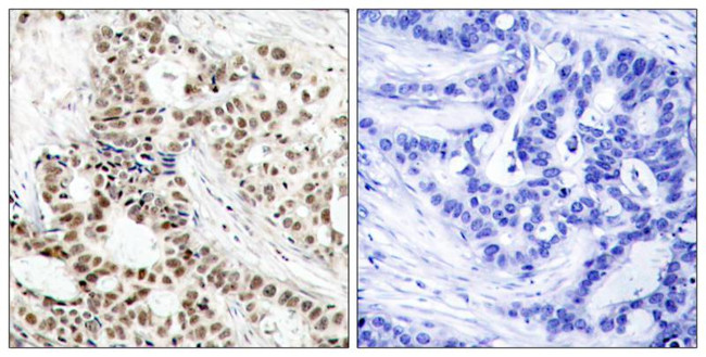 Phospho-BRCA1 (Ser1423) Antibody in Immunohistochemistry (Paraffin) (IHC (P))